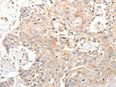 STX1A Antibody