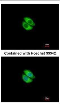 Syntrophin alpha 1 Rabbit Polyclonal Antibody