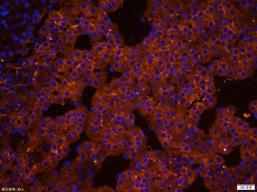 SYP antibody