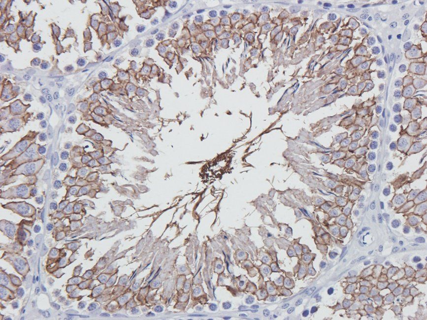 SYP antibody