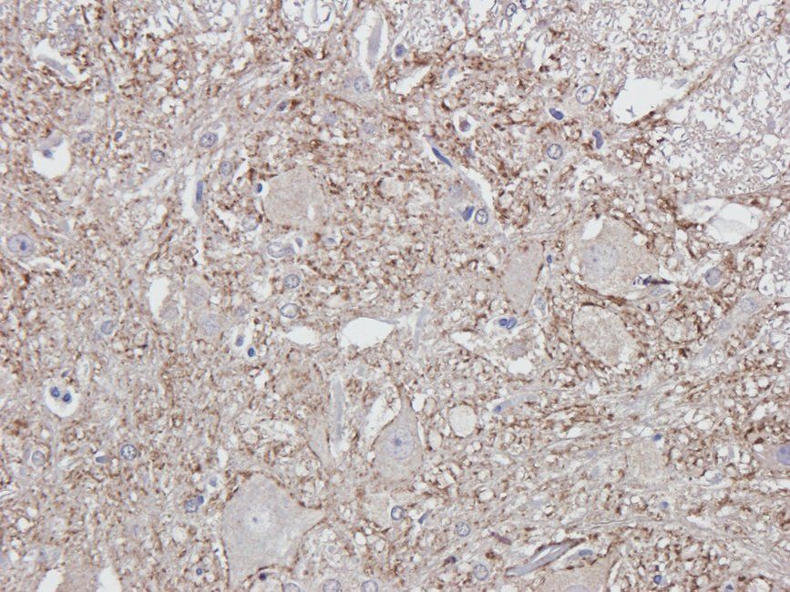 SYP antibody