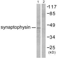 SYP antibody