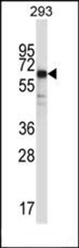 SYT6 antibody