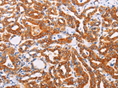 SYVN1 Antibody
