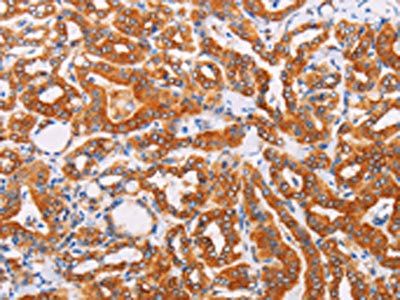 SYVN1 antibody