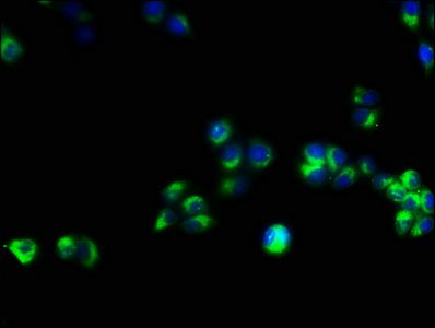 T-cell surface glycoprotein CD3 epsilon chain antibody