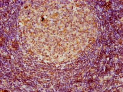 CD3E Antibody