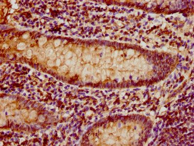 T-cell surface glycoprotein CD3 epsilon chain antibody