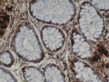 Mouse Human T-Complex Protein 1, subunit Antibody