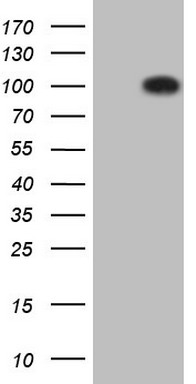 ROR1 Antibody