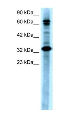 TAB2 antibody