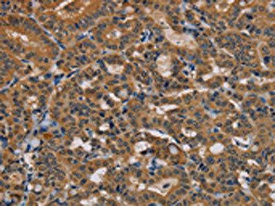 TAB3 Antibody