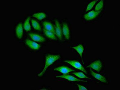 TAB3 Antibody