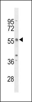 TAC2N antibody