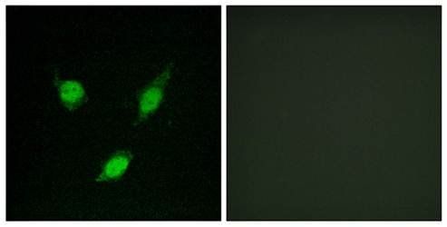 TACC1 antibody