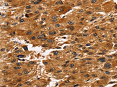 TACC2 Antibody
