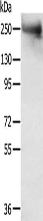 TACC2 antibody