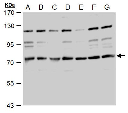 TACC2 antibody