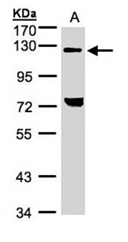 TACC2 Rabbit Polyclonal Antibody