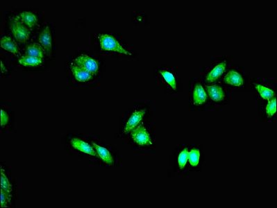 TACC3 antibody