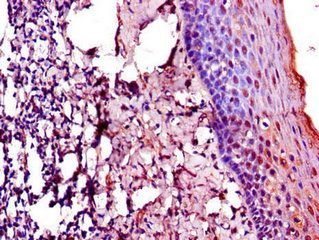 TACC3 Antibody