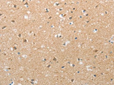 TACR2 Antibody