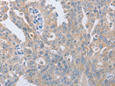 TACR2 Antibody