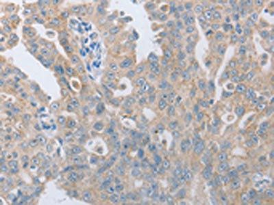 TACR2 antibody