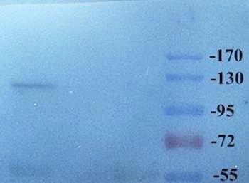 ATAD2 Antibody