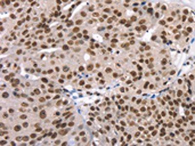 TAF15 antibody