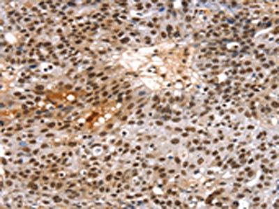 TAF15 Antibody