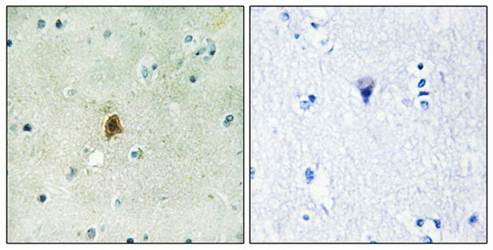 TAF15 Antibody