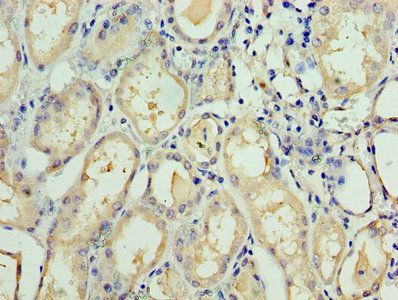 TAF1C Antibody