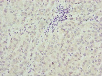 TAF5 Antibody