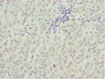 TAF5 antibody