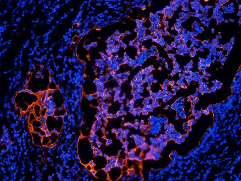 TAG-72 antibody