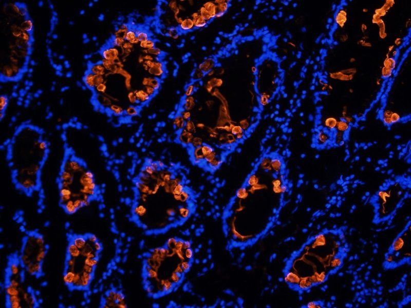 TAG-72 antibody