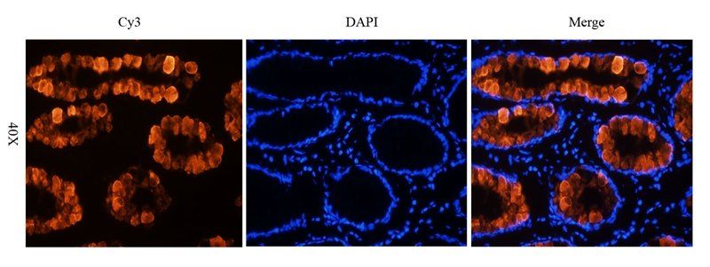 TAG-72 antibody