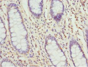 TAGLN2 Antibody