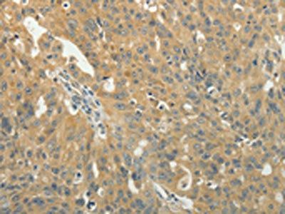 TAGLN2 Antibody