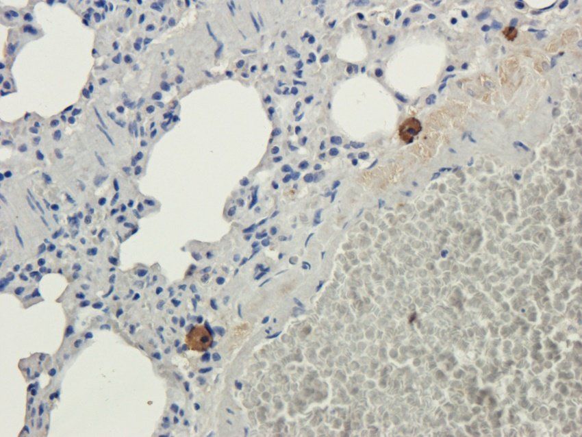 TAL1 antibody