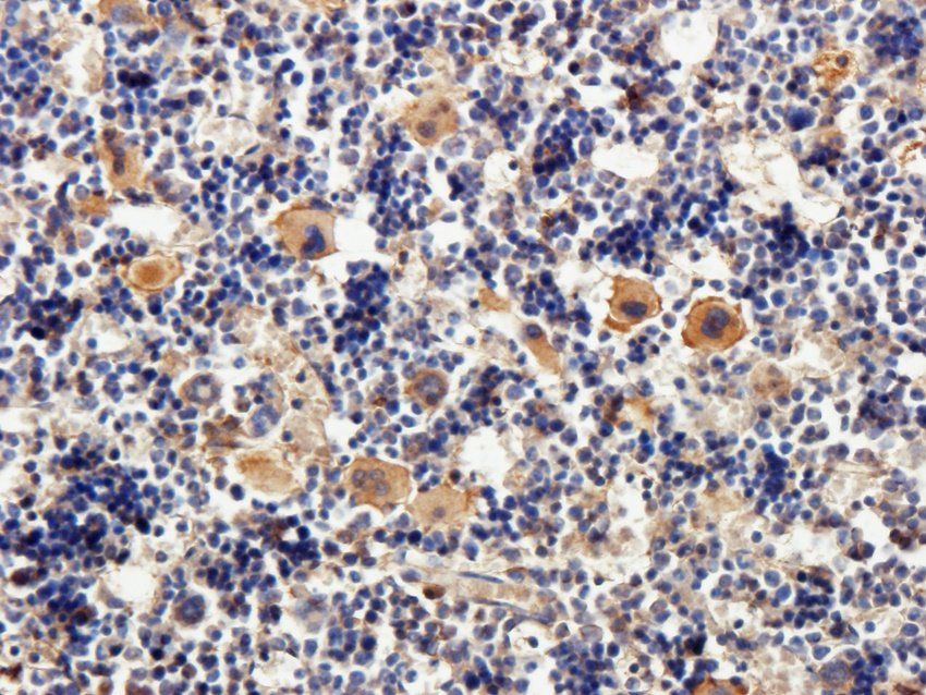 TAL1 antibody