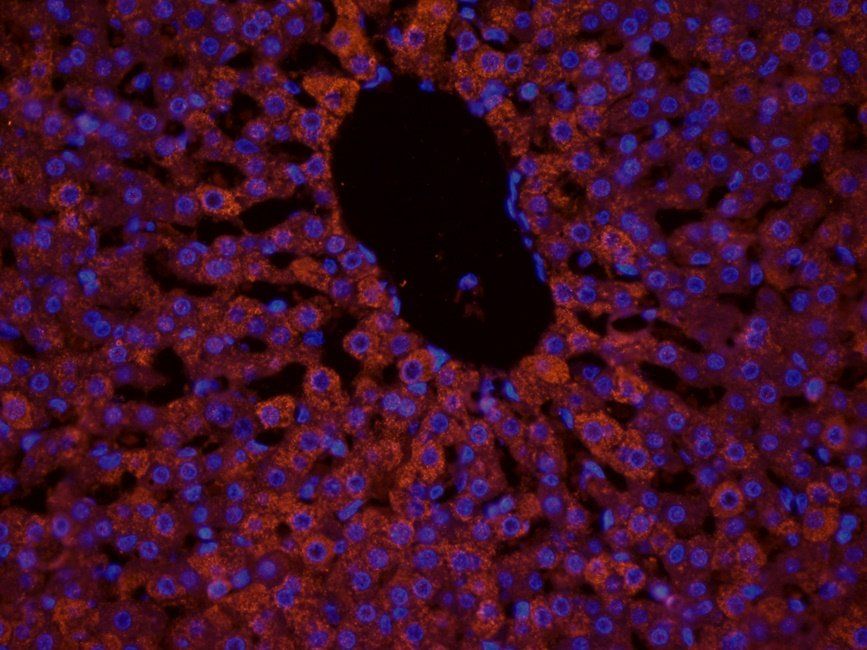 TAL1 antibody