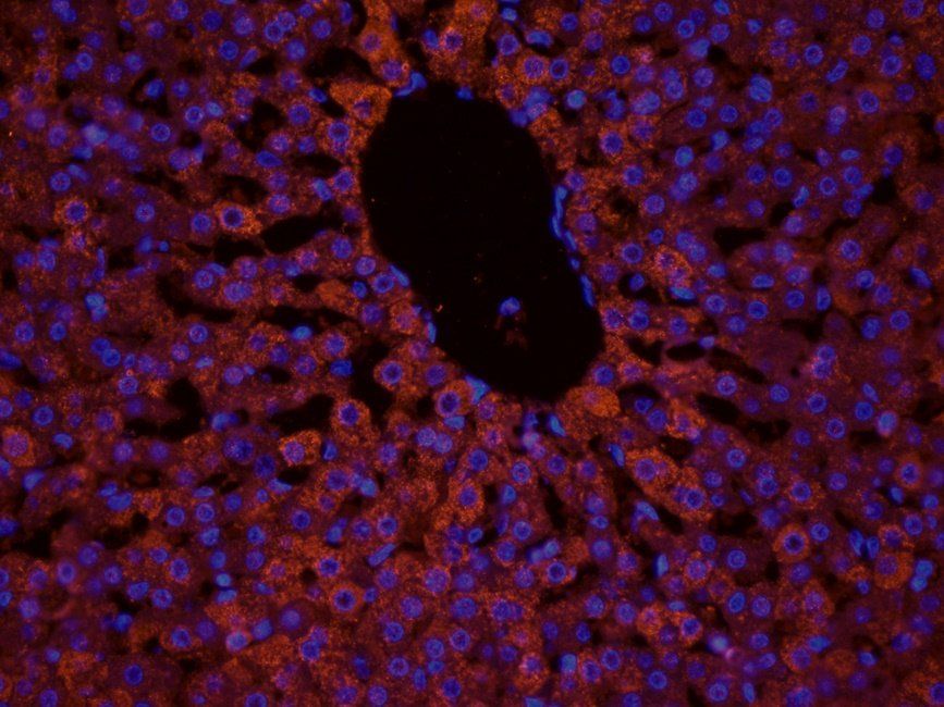 TAL1 antibody