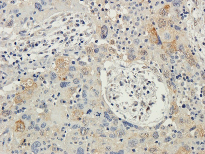 TAL1 antibody