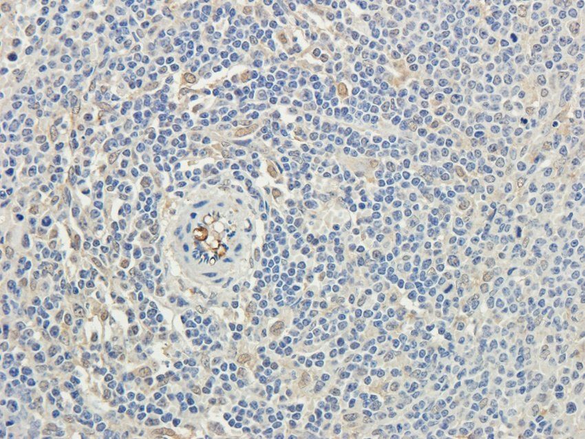 TAL1 antibody