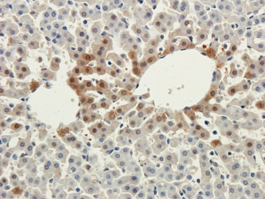 TAL1 antibody