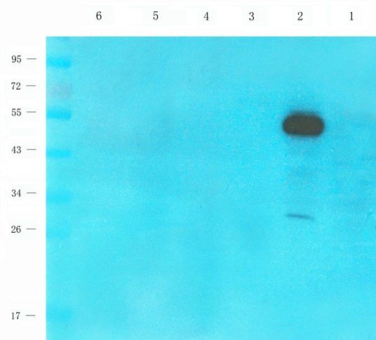 TAL1 antibody