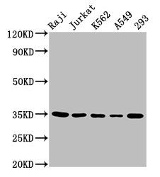 TAL1 antibody