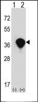 TALDO1 antibody